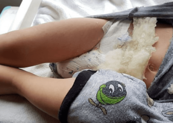 Alvás közben robbant fel a kisbabán a pelenka