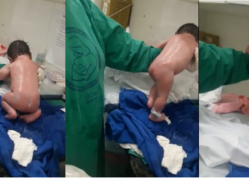 Születése után azonnal járni kezdett az újszülött – videó