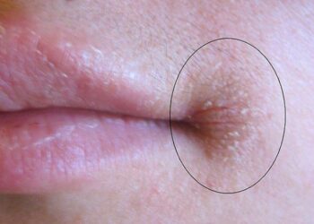 9 jel, amely egy nő elhanyagolt külsejére utal!