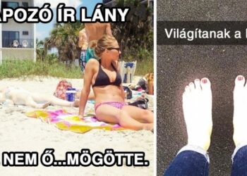 17 probléma, amelyet csak a rendkívül fehér bőrű emberek érthetnek