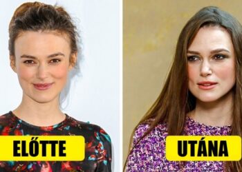 7 rendkívül furcsa mód, ahogy egy nő teste megváltozhat a szülés után