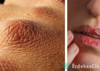 Ez a 8 szemmel látható jele annak, hogy túlságosan kevés vizet iszunk