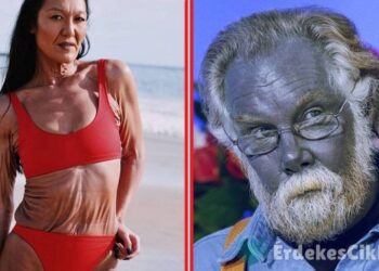 9 hihetetlen genetikai rendellenesség, mely előnyt kovácsolt tulajdonosaiknak