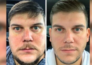 Ez történik a testünkkel, hogyha 28 napig nem fogyasztunk alkoholt