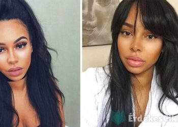 Ez a csinos modell megmutatta testét szülést követően. Sokan karrierje végét jósolják