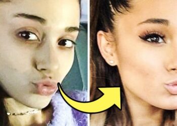 20 hollywoodi celeb, aki nem félt smink nélkül is megmutatni magát