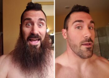 20 kép, amely bemutatja, hogy miért is olyan érzékeny pont a férfiaknál a szakáll