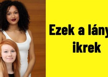 16 ritka és különleges eset, amelyet a genetika eredményezett