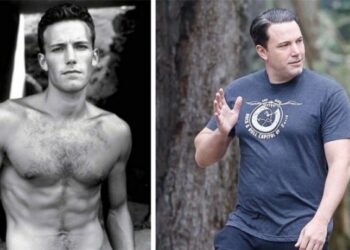 20 celeb, akinek a szépsége látványosan megkopott az évek során