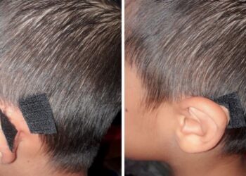 18 agyament ötlet, mely bemutatja, hogy mindenre létezik megoldás