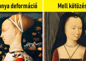 10 borzasztó szépségszabvány, amit nehéz elképzelni, hogy a múltban használtak