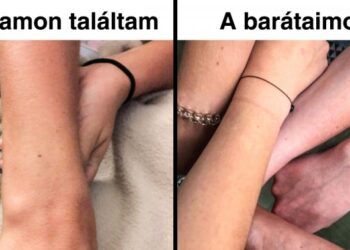 Kiderült: a világon majdnem minden nőnek pontosan ugyanolyan anyajegye van