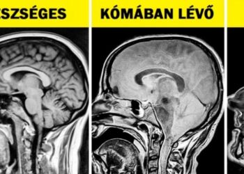 16 röntgenkép, ami többet elárul a testünkről, mint a biológia tankönyvek