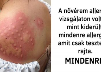 24 személy, akinek biztosan százszor szarabb napja van, mint neked