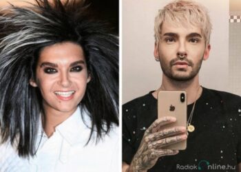 13 celeb, akik drasztikus módon változtatták meg kinézetüket.