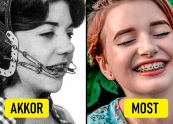 16 rettenetes szépészeti eszköz a múltból