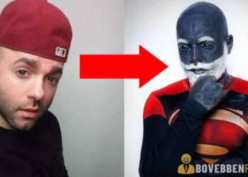 33 éves srác kitetováltatta az egész testét és eltávolíttatta a férfiasságát, hogy legyőzze a depresszióját