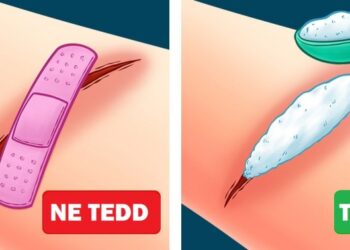 10 villámgyors elsősegélynyújtási tipp, ami megmentheti a napodat