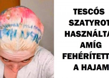 20+ reményvesztett nő, akinek áldozathozatala a szépségért ment a lefolyóba