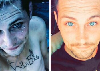 21 előtte-utána fotó emberekről, akiknek sikerült legyőzniük a káros szenvedélyeiket