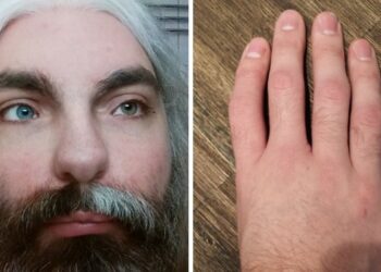 15 személy, aki bizonyítja, hogy a természet mindenre képes