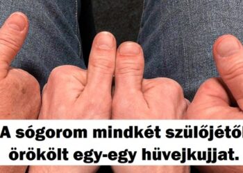 20 személy, akik megtestesítik a genetika csodáit