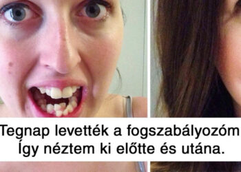 Az internetezők megmutatták, miként változott a megjelenésük, miután egyvalamit kijavítottak magukon