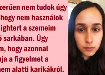 16 nő, akik megmutatták, hogy a „no-makeup” smink hogyan változtathatja meg az arcod