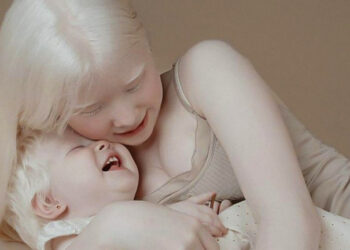 Albínó nővérek, akik 12 év különbséggel születtek, a fényképeikkel izgalomba hozzák az internetet