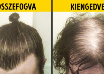 18 felvétel, mely igazolja, hogy minden frizura mögött érdekes sztori rejlik