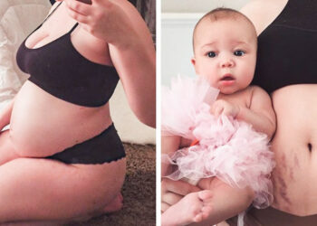 15 terhesség előtti és utáni kép, ami bemutatja a születés csodáját