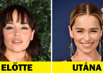12 sztár, akik csak egy dolgot változtattak a megjelenésükön, és sokkal vonzóbbá váltak
