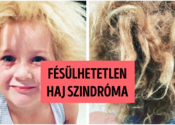 20 személy, akit szokatlan testi jellemzőkkel ruházott fel a természet