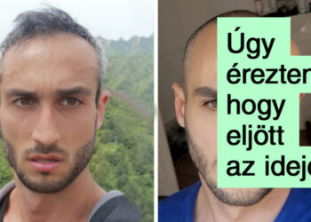 20 férfi, aki úgy döntött, hogy kipróbálja a kopaszságot, és nagyon jól tette