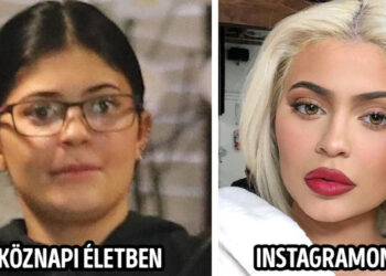 17 fénykép arról, hogyan változtatta meg a hírnév és a pénz a legnépszerűbb celebek külsejét