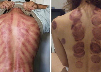 10+ fénykép, mely igazolja, hogy egy “jó” masszázs eredményét nem csak érezni, de látni is lehet