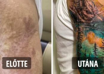 20 tetoválás, amely a hegekből és sérülésekből lélegzetelállító műalkotásokat csinált
