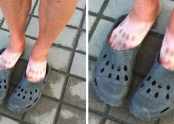 30 vicces alkalom, mikor az emberek alábecsülték a napsütés erejét