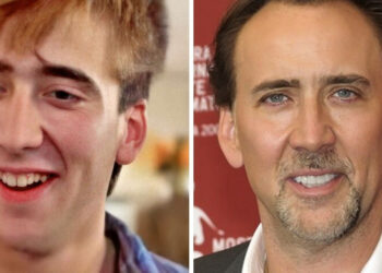 14 sztár, akik hirtelen tökéletes mosolyt kaptak, miután átléptek a hírnév küszöbén