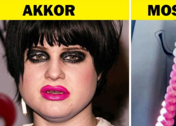 13 sztár, akik radikális átalakításon estek át