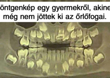 16 röntgenfotó, amely felfedi a körülöttünk lévő világ rejtett oldalát