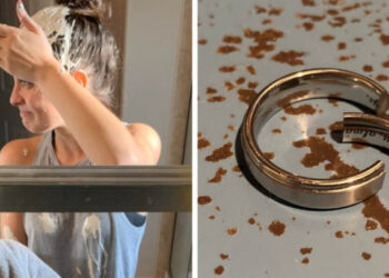 20 alkalom, mikor az emberek balszerencsések voltak, és a bőrükön érezték a fájdalmát