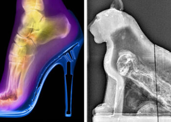 16 alkalom, mikor a röntgensugarak olyan titkokat fedtek fel, melyek eddig rejtve voltak a szemünk elől