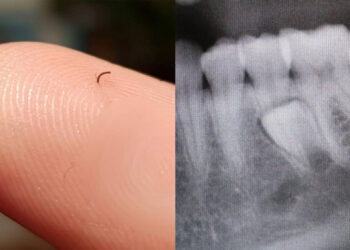 20 személy, akik nem számítottak ilyen meglepetésre a saját testüktől