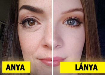 15+ személy, akiknek nincs szükségük DNS-tesztre annak bizonyításához, hogy ugyanaz a vér folyik az ereikben