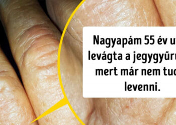 21 fénykép, amely bemutatja, milyen látványos változást okoz az idő múlása a mindennapi tárgyainkban