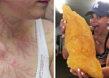 15 érdekes fotó, amely bebizonyítja, hogy az emberi test a természet csodája