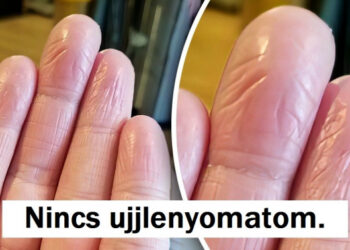 20 személy, aki felfedezett valami egyedit a testén