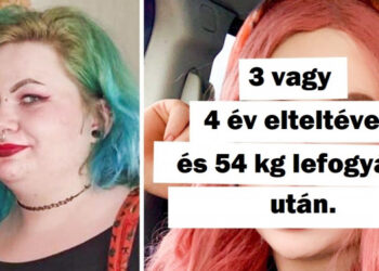 19 személy, akik rút kiskacsából gyönyörű hattyúvá változtak