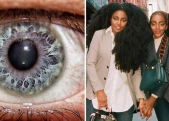 17 személy, aki megnyerte a genetika-lottót